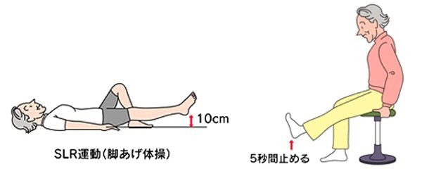 大腿四頭筋の強化例